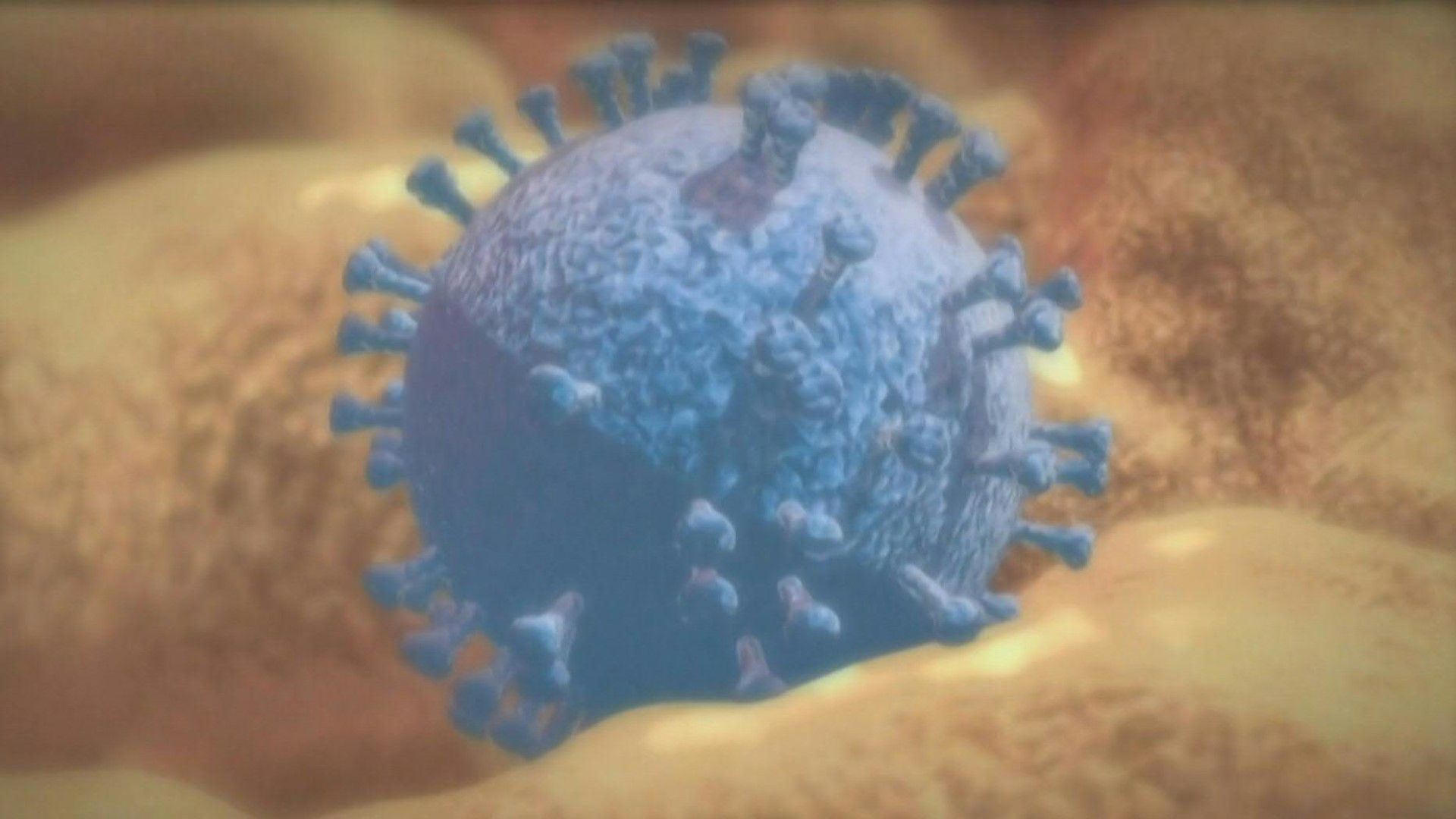 Videografik: HIV und Aids