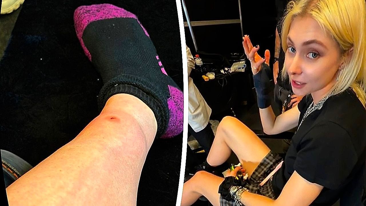 Video: Rock singer Taylor Momsen bitten by venomous spider moments before taking stage