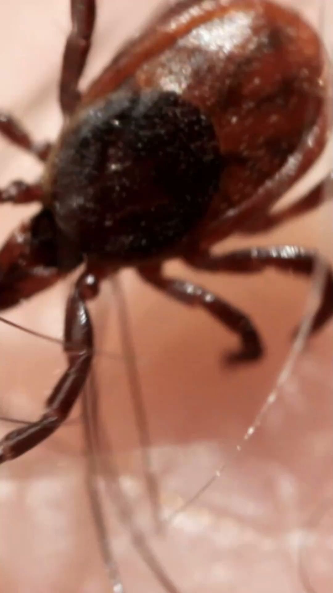 Protection against ticks and tips for what to do after a bite