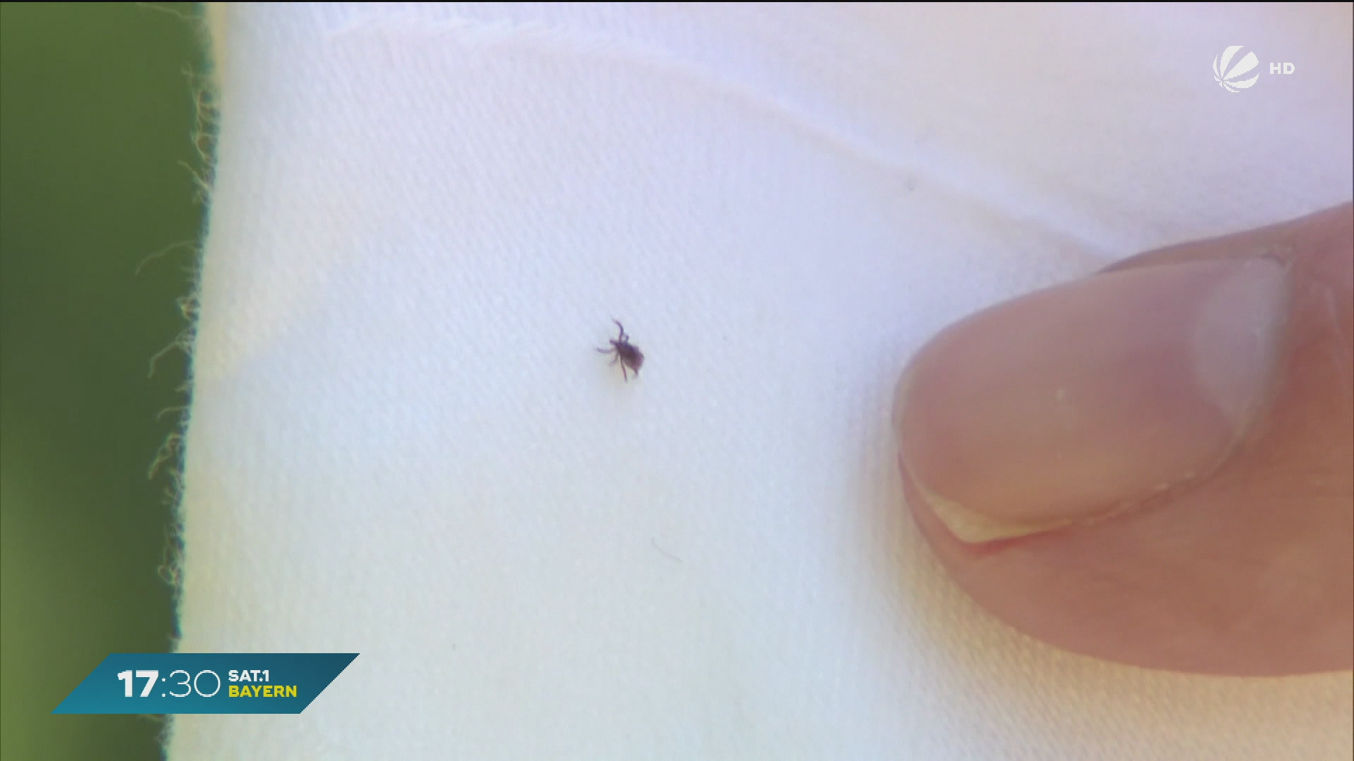 Video: Mehr Borreliose-Fälle in Bayern: Patientin mit schwerem Verlauf