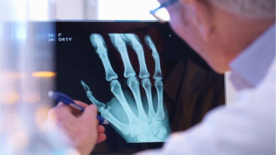 Unfälle durch Winterwetter: Notaufnahmen belastet